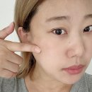 밤비에스테틱 | 이천에스테틱 밤비뷰티 히알스킨필름 재생수분관리 후기