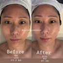 코아메디칼 | 수원피부관리_보엘르 에스테틱 이지다 숨결클렌징으로 피부관리의 답을 찾다