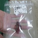 이마트24 이대목동병원점 | (갑상선암 수술) 이대목동병원 갑상선암 수술 실제후기 (수술과정/수술비용)