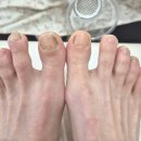 꽃길뷰티 | 동탄 문제성 발톱 관리, 발톱무좀 관리 전문샵 네일도 꽃길, 무좀 관리 후 젤패디 후기
