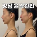 다이아에스테틱 | 강남 윤곽관리 다이아에스테틱 안면비대칭 얼굴PT 후기