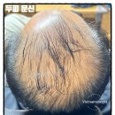 뷰티솔루션 이미지