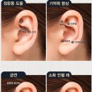 귀건강(이혈테라피) 이미지