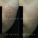 연세지움 Daum카페