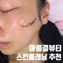 아름결 | 개금스킨플래닝 피부결 정돈으로 화장 뜸 해결 아름결뷰티 +후기