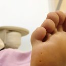 레푸스 연산점 이미지