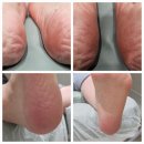 오니크네일 이미지