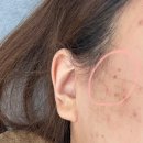 한내로 | [인천] 청라 잡티관리 디어브로우&amp;셀핏바디피부 잡티관리 후기