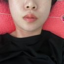 케이스크린골프존 | 과천피부관리 제대로 찾고싶다면 연테라피, 머리부터 발끝까지 전신 관리 솔직후기