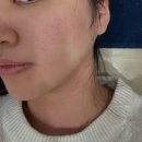 루메이 | 부산 온천장 피부 모공 수분관리 하이퍼젝션 후기 ‘루메이 에스테틱’