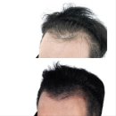 닷채디자인센터 | 부천 두피 문신 잘하는 곳-닷채디자인센터
