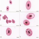무지개송어의 Staphylococcus warneri 이미지