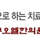 큐오엘