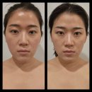 동대구역피부관리 예림스킨앤바디 파워트리 얼굴윤곽케어 후기