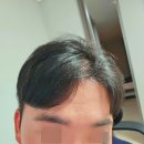 심플리안