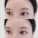 선'브로우