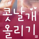 이근치과의원 | 양악수술후 콧날개 처짐