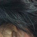 울림숲난청연구소 보청기 이미지