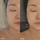 세븐일레븐 부산마린시티자이점 | 해운대윤곽관리 고민된다면 에스테티아 마린시티점 솔직 체험 후기