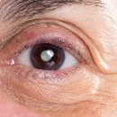 경산제일안과 이미지