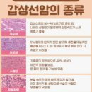 김수연유의원 | 갑상선암/췌장 신경내분비종양 검사결과(23년 12월) 갑상선암 유두암확진 + 췌장 CT결과