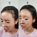 아이버리 헤어