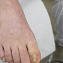 중앙동247 | 진주 중앙동 내성발톱 벗어나고 싶다면 후네일&amp;베어진주장대점 추천해요!