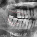 리봄치과의원 네이버블로그