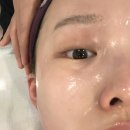 테라피 드 포레 | 압구정역 피부관리 | [테라피 드 포레] 기본얼굴케어 후기