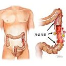 아랫배통증 왼쪽아랫배통증 오른쪽아랫배통증 이미지