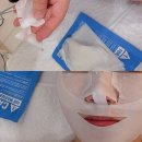 이완춘 | 청주피부관리 청춘미남에서 진행한 청주슈퍼젝션 케어 후기