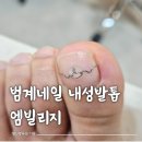 3468 | 범계네일 엠빌리지 범계본점 내성발톱 파고드는발톱 관리 후기