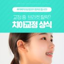 루미에치과교정과치과의원 | 의정부역교정치과 교정 브라켓이 떨어졌다면? 이렇게 대처하세요