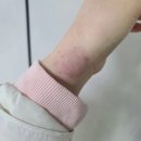 (주)코리아메디칼디바이스 | 손목 마사지기 추천 손목보호대로도 추천하는 아나파 손목 마사지기로 통증 줄여봐요!