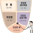 우리 몸이 보내는 작은 '이상 신호' 이미지