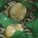 복음치과기공소 이미지