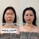 젠 | [구미 인의동 피부관리] 얼굴 작아지는 효과 대박! 구미시 에스테틱 전문점 젠에스테틱 후기