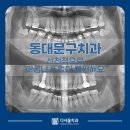 다서울치과의원 | 동대문구치과 선천적으로 어금니가 없어 불편해요