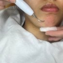 솔브 | 운정피부관리 '스킨솔브' 여드름압출 단백질케어어 후기