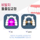 미소담치과 이미지