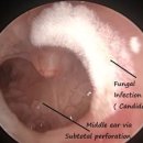 포낙보청기 마포센터 이미지
