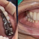 이로운덴탈 이미지