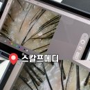 원메디케어 | 평택두피관리 더365의원 두피클리닉 스칼프메디 엄마 두피케어 후기