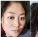 "코로나 확진 후 얼굴·혀 검게 변했다"…중국 신종변이 공포 이미지