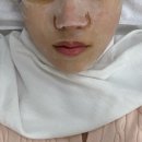 합성대로상가 | 공덕피부관리 피부보기 콜라겐부스트 테라피 후기