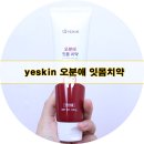 예스킨케어 | 잇몸염증 케어하기 예스킨 오분애 잇몸치약