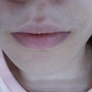 라벨르백옥 | 인중 왁싱 후기