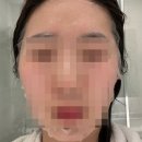 오에스플라 | 지친 피부에, 한 장의 휴식 PLLA 플라필스 콜라겐 부스터 NMN BIO 마스크팩 후기 💙