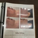 정아 | 창원 중동 피부 탄력 관리 맛집 정아하다에스테틱 솔직 후기