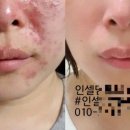 퍼스트클린업 이미지